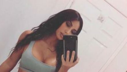 Ким Кардашьян призналась, что страдает от серьезного кожного заболевания