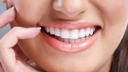Perfect Smile Veneers – инструкция к съемным винирам, отзывы