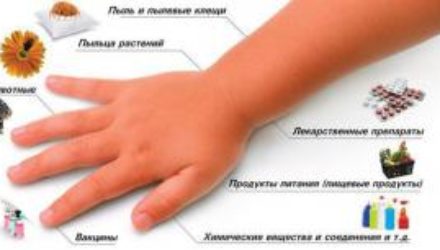 Как предотвратить аллергию?