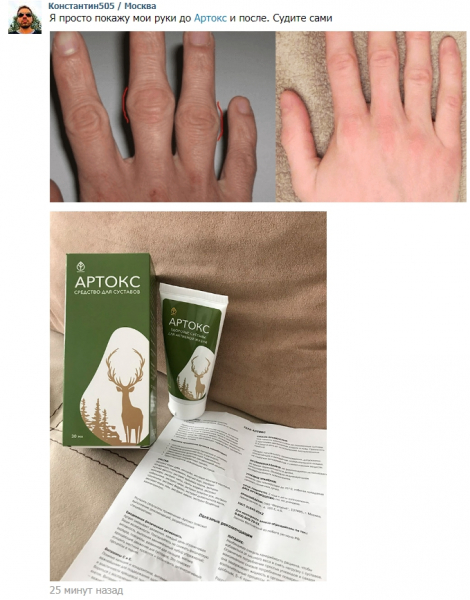 
Артокс гель для суставов 