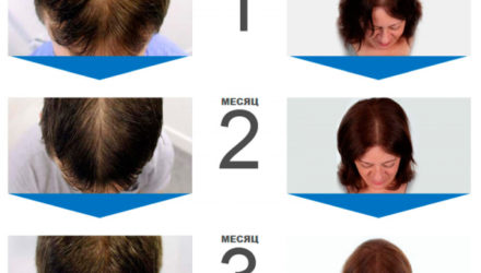 Perfect Hair для волос  — 18 отзывов (развод или правда): реальные и отрицательные мнения покупателей и специалистов, где купить, цена, инструкция по применению