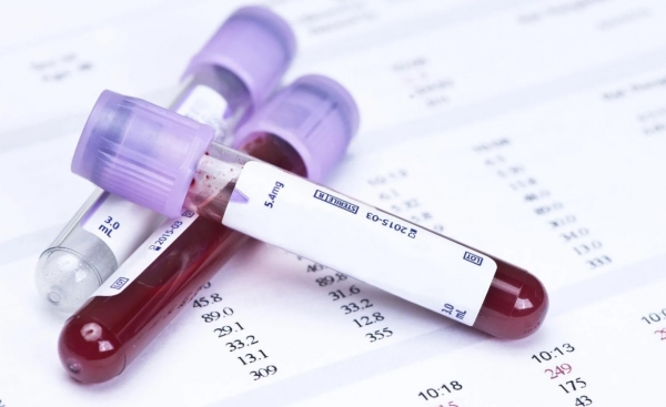 
Можно ли диагностировать рак по анализу крови 