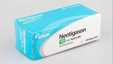 Неотигазон — инструкция по применению  — 18 отзывов (развод или правда): реальные и отрицательные мнения покупателей и специалистов, где купить, цена, инструкция по применению