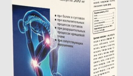 Radius  — 18 отзывов (развод или правда): реальные и отрицательные мнения покупателей и специалистов, где купить, цена, инструкция по применению