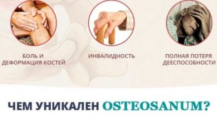 Оsteosanum крем для суставов и связок  — 18 отзывов (развод или правда): реальные и отрицательные мнения покупателей и специалистов, где купить, цена, инструкция по применению