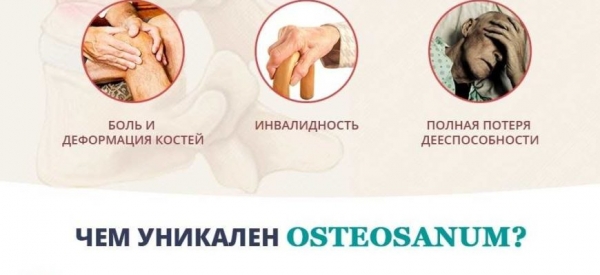 
Оsteosanum крем для суставов и связок 