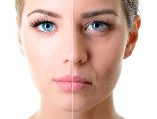 
				Адапалекс (Adapalex) – эффективный антивозрастной крем			