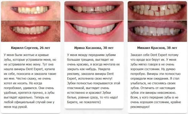 
				Dent Expert виниры для зубов			