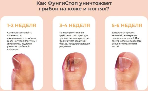 
				ФунгиСтоп мазь от грибка			