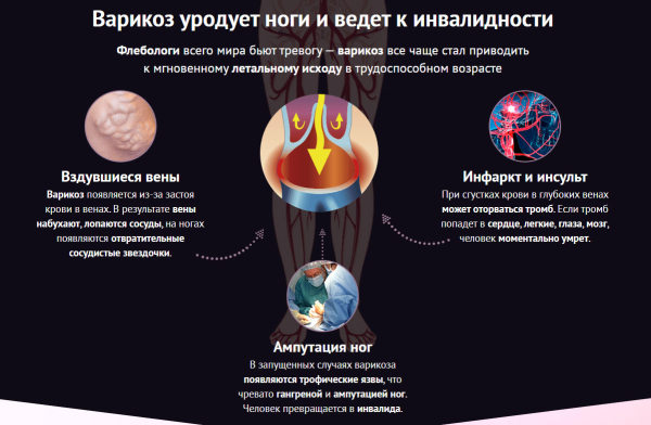 
				Delaven поможет от вен			