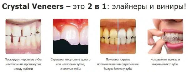 Crystal Veneers виниры для зубов
Crystal Veneers виниры для зубов