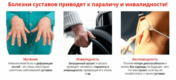 
				Монастырская травница — мазь для лечения суставов			