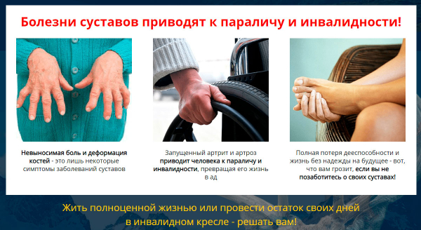 
				Artox для здоровья суставов			