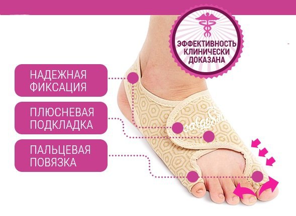 Valgosocks: Подробный Обзор Ортопедических Фиксаторов для Здоровья Ваших Стоп — Фото 6