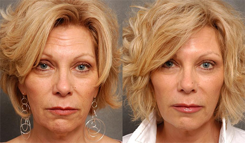 
				Золотая маска CledBel			