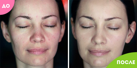 
				Золотая маска CledBel			