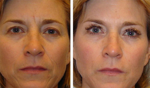 
				Золотая маска CledBel			