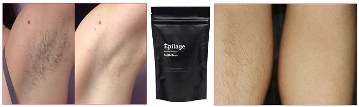 Гладкая кожа до 4 недель: всё, что нужно знать о воске для депиляции Épilage — Фото 6