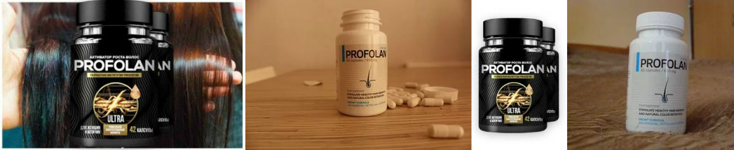 Profolan: Комплексный Обзор Поддержки для Здоровья и Роста Волос — Фото 2