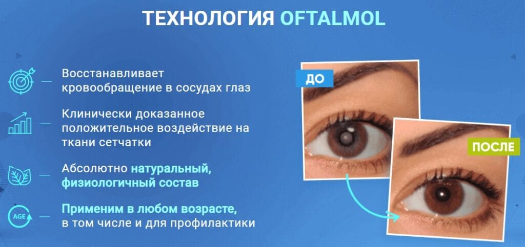 Oftalmol - капсулы для зрения — обзор и инструкция по применению — Фото 8