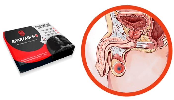 Spartagen: Поддержка мужского здоровья и выносливости – подробный обзор — Фото 1