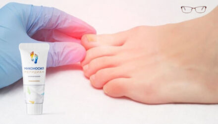 Миконосил Меридиан: Комплексный подход к поддержанию здоровья кожи и ногтей