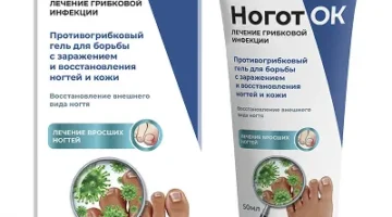 Ноготок — мазь от грибка			: реальные и отрицательные мнения покупателей и специалистов, где купить, цена, инструкция по применению