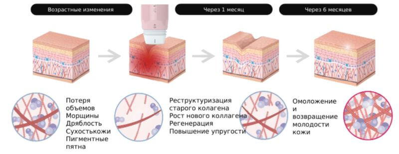 Prima: Раскрывая потенциал натурального омоложения кожи — Фото 2